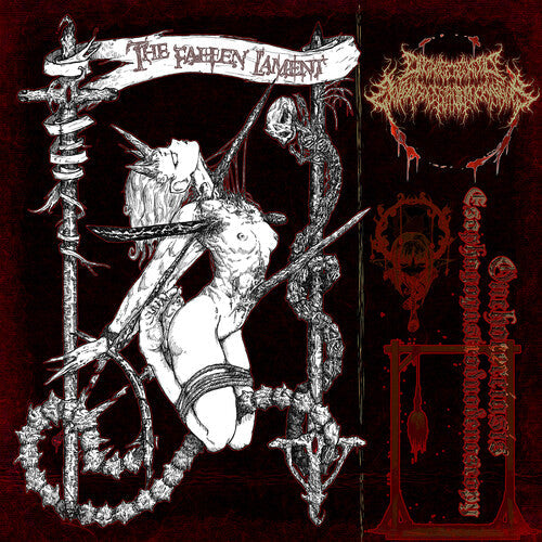 Onchocerciasis Esophagogastroduodenoscopy: The Fallen Lament - CD